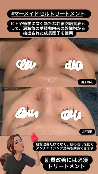 LiZA エステティックサロンのエステ・リラクイメージ