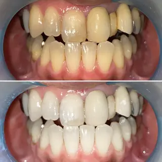 ホワイトニングサロン SHILONのエステ・リラクイメージ