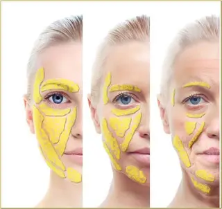 SESUNNY セサニー SEIRAのマツエク・マツパデザイン