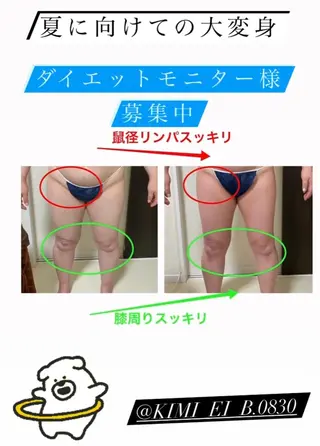 ダイエット／脱毛 美顔／フォト／ハーブのその他イメージ