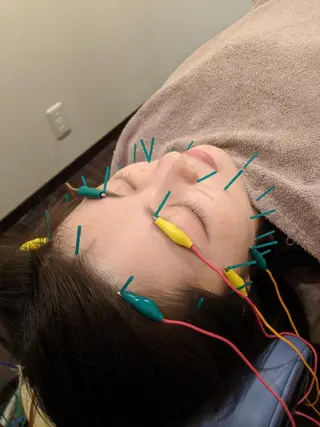 乃々鍼灸・整体院　表参道所属・乃々鍼灸整体院　植木 　【美容鍼/整体】のエステ・リラクイメージ