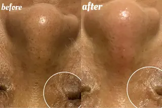 Nature Souce毛穴専門店のその他イメージ