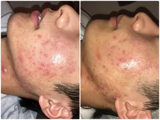 BUB PIBのエステ・リラクイメージ