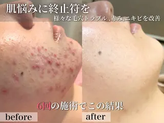 フェイシャル/脱毛 ジョアアンジェ竹田のエステ・リラクイメージ