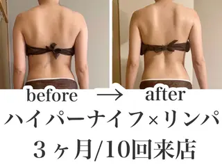 REME/リミー エステサロン東大宮店所属・小林 雪乃のエステ・リラクイメージ