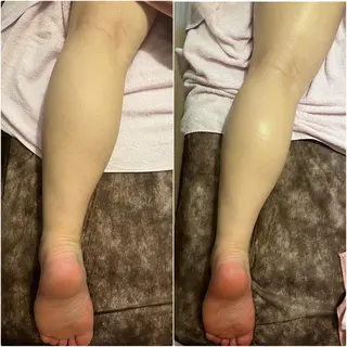 アロマ･美容鍼･カッ ピング「麗」鍼灸院のエステ・リラクイメージ