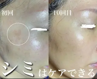 大阪守口市【シミ専門】Peach所属・【シミ専門サロン】 Peachのエステ・リラクイメージ