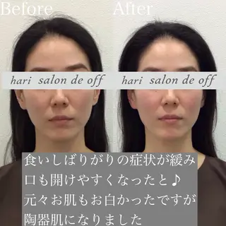 整体×美容鍼灸 鍼灸師Miyanoのエステ・リラクイメージ