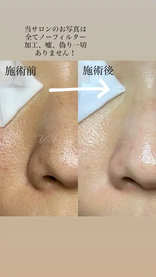 Eyelash salon MORE(モア)所属・安納 麻穂のエステ・リラクイメージ