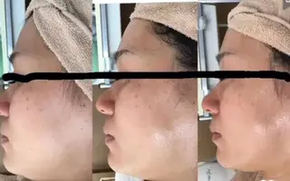 ヤマダ アキナのエステ・リラクイメージ