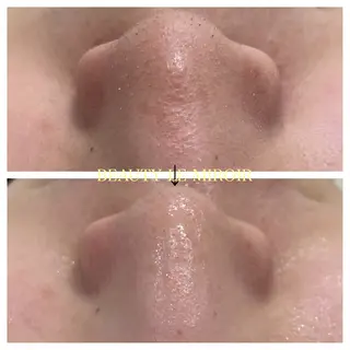 ビューティー ミロワールのエステ・リラクイメージ