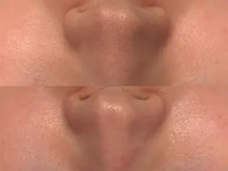 べアール所属・小顔/毛穴/ニキビ salon bealのその他イメージ