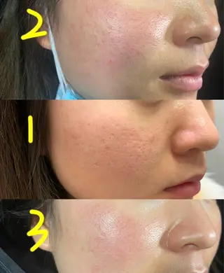 マツエク・マツパ 愛維美水光美肌専門店所属・愛維美水光美肌専門店 メンズレディースokのエステ・リラクイメージ