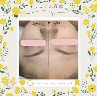 🌿小顔・痩身・脱毛 レイビス川崎店🌿のエステ・リラクイメージ