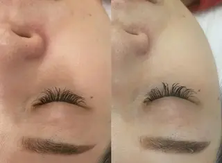 aliaハイフ&水光ジェットサロン所属・aliaハーブ水光店 エステティシャン募集のエステ・リラクイメージ