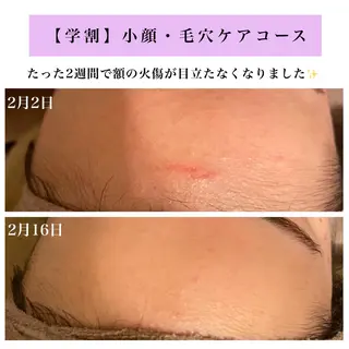 Bellesthe (ベルエステ)のエステ・リラクイメージ