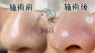 Lipula リプラ所属・毛穴ツヤ肌専門    Lipulaのエステ・リラクイメージ