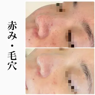 ハーブピーリング専門 BIOPLUS＋川崎のエステ・リラクイメージ