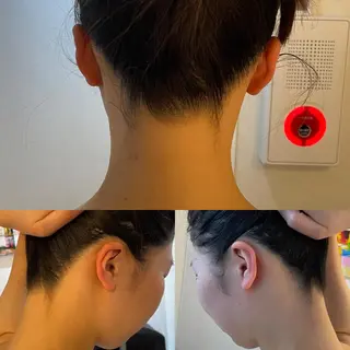 うなじ脱毛/美肌脱毛 LABELのエステ・リラクイメージ