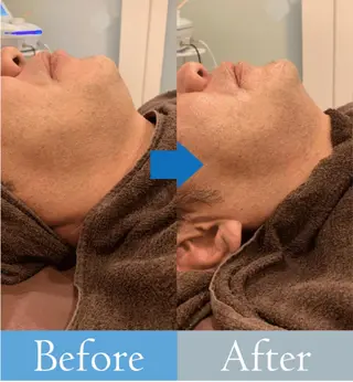 美肌/小顔/眉毛の 専門店 ルミナスのエステ・リラクイメージ