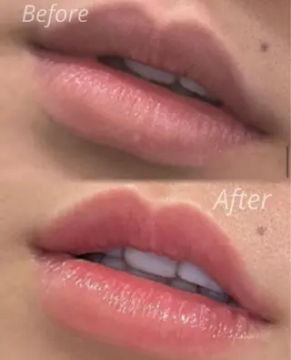 ＋belle所属・＋belle山梨 sahoのエステ・リラクイメージ