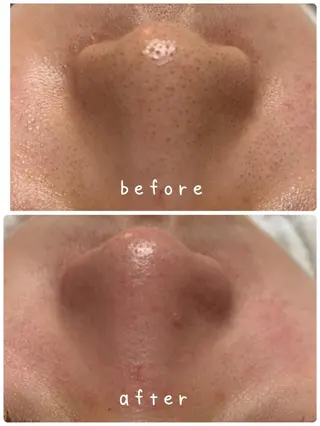 プライベートサロンCuara所属・プライベートサロン Cuaraのエステ・リラクイメージ