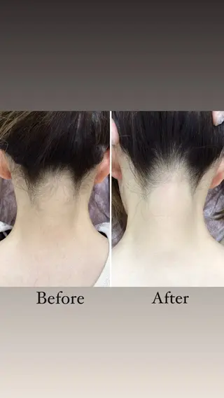 LiLL by Andre beauty所属・LiLL 熊本のエステ・リラクイメージ