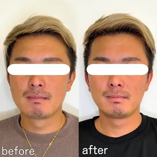 小顔矯正&美容整体 整え屋REDオーナーのエステ・リラクイメージ
