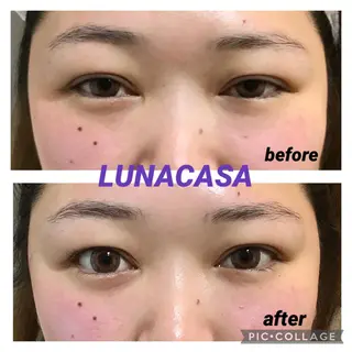 マツエク・マツパ ルナ カーザのマツエク・マツパデザイン