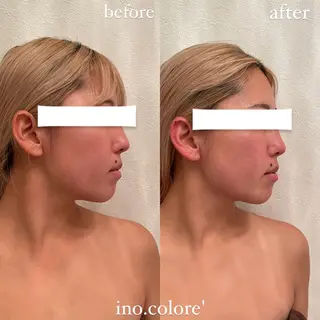 エステサロンino.colore'所属・小顔サロン ino.coloreのエステ・リラクイメージ