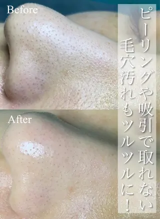 Privatesalon PARIS ELLY 美肌脱毛所属・ELLY 美肌脱毛のエステ・リラクイメージ