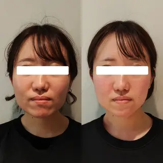 美容鍼灸サロンAria所属・美容鍼サロンAria 杉元みつるのエステ・リラクイメージ