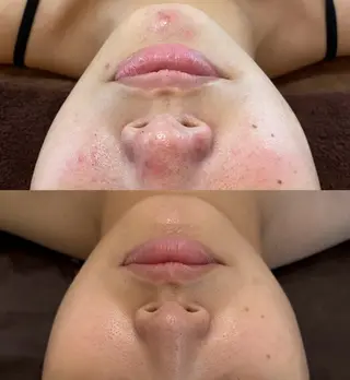 Nicore所属・肌質改善🌿まつ毛 chapiのその他イメージ