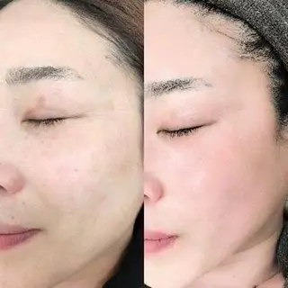 TRUE CARE所属・ハーブピーリング/ 上本町/美肌/幹細胞のエステ・リラクイメージ