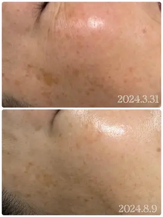 Luquias ルキアスのエステ・リラクイメージ