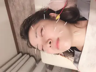 むくみたるみ専門☆ 美容鍼・小顔矯正のエステ・リラクイメージ