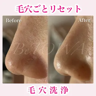 BeTOWA所属・BeTOWA 毛穴洗浄/Wax脱毛のエステ・リラクイメージ