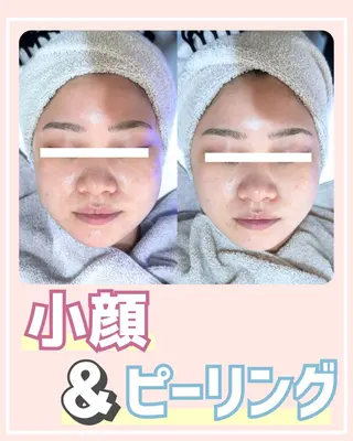 |ピーリング・毛穴| soina神楽坂のエステ・リラクイメージ