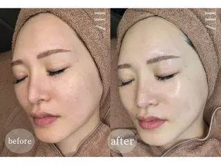 ＆epi 【エステ】のエステ・リラクイメージ