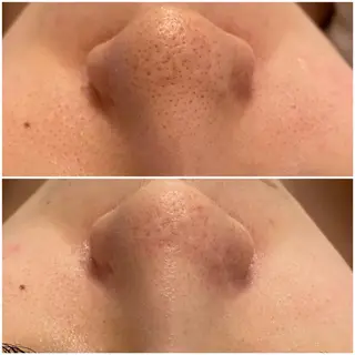 ララ/ハーブ メゾンリュバンのエステ・リラクイメージ