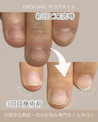 ネイル KIKOA NAIL キコアネイルのネイルデザイン