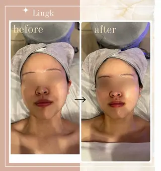 LingK/Este 中松 聖奈のエステ・リラクイメージ