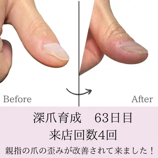 ネイル 𝐴𝑁𝑈𝐸 深爪育成専門サロンのネイルデザイン