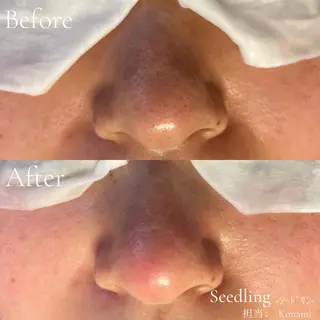 シードリン 府内店 小波のエステ・リラクイメージ