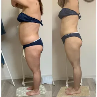 美ボディメイクサロン　only one body所属・所沢 痩身エステサロンのエステ・リラクイメージ