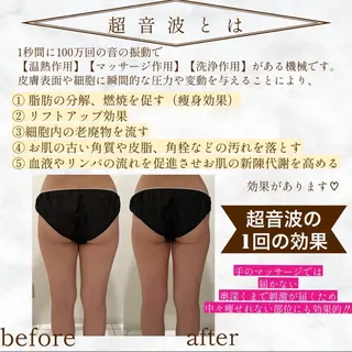 パルティール渋谷店所属・神宮司 はるかのエステ・リラクイメージ