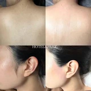 HOTEL&PARK .Moeワックス脱毛のエステ・リラクイメージ