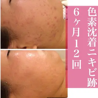 ミディアム カラー パーマ ヘアアレンジ メンズ キッズ ネイル マツエク・マツパ アイブロウ ニキビ・肌質改善専門 ♡人生が変わるサロンのエステ・リラクイメージ