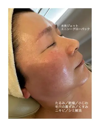 うなじ脱毛/美肌脱毛 LABELのエステ・リラクイメージ