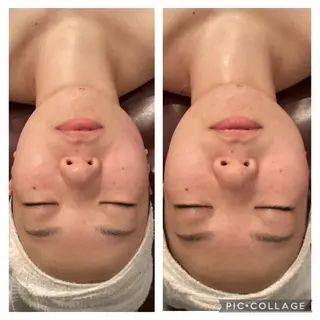 メディカルエステ 痩身·小顔専門サロンBBC 田園調布所属・KEI KOのエステ・リラクイメージ